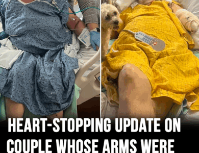 Couple who lost their arms in tornado reunites Couple who lost their arms in tornado reunites