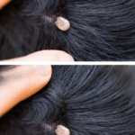 What You Should Do If You Discover Something Strange in Your Child’s Hair What You Should Do If You Discover Something Strange in Your Child’s Hair