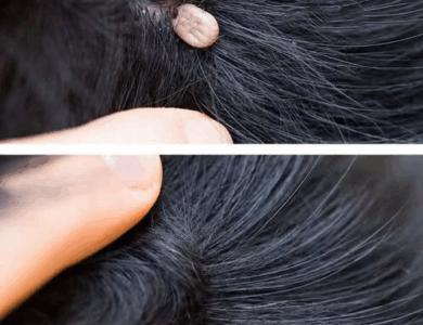 What You Should Do If You Discover Something Strange in Your Child’s Hair What You Should Do If You Discover Something Strange in Your Child’s Hair