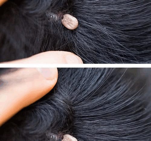 What You Should Do If You Discover Something Strange in Your Child’s Hair