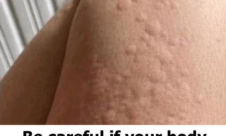 Why do hives appear on the skin? These are the surprising factors you might not know about.