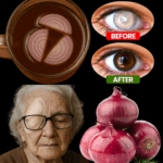Improve Your Eyesight Naturally at Home in 5 Days – With Onion? Here’s the Truth! Improve Your Eyesight Naturally at Home in 5 Days – With Onion? Here’s the Truth!
