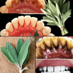 Remove Tartar and Whiten Your Teeth Naturally with Sage Leaves Remove Tartar and Whiten Your Teeth Naturally with Sage Leaves