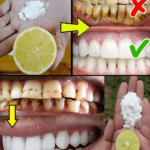 Lemon and Baking Soda: The Simple Secret to a Brighter, Natural Smile Lemon and Baking Soda: The Simple Secret to a Brighter, Natural Smile