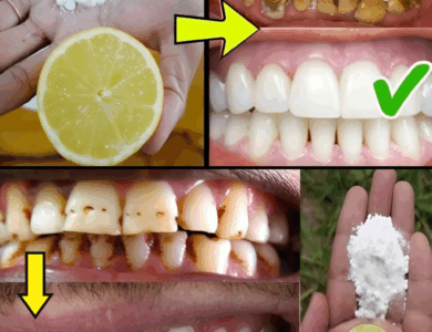 Lemon and Baking Soda: The Simple Secret to a Brighter, Natural Smile Lemon and Baking Soda: The Simple Secret to a Brighter, Natural Smile