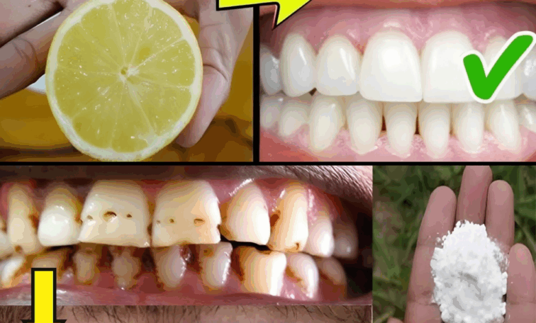 Lemon and Baking Soda: The Simple Secret to a Brighter, Natural Smile Lemon and Baking Soda: The Simple Secret to a Brighter, Natural Smile
