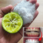 Unlock a Dazzling Smile: Natural Teeth Whitening Secrets You’ll Wish You Knew Sooner Unlock a Dazzling Smile: Natural Teeth Whitening Secrets You’ll Wish You Knew Sooner