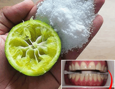 Unlock a Dazzling Smile: Natural Teeth Whitening Secrets You’ll Wish You Knew Sooner Unlock a Dazzling Smile: Natural Teeth Whitening Secrets You’ll Wish You Knew Sooner